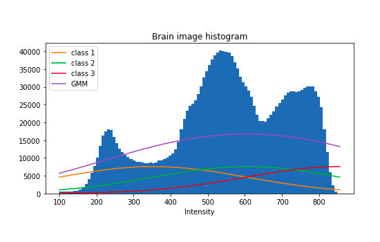 Image intensities histogram where we superimpose our GMM with our initialization of the parameters.