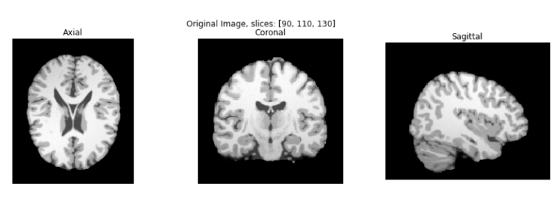 Input image: Axial, Coronal and Sagittal view.