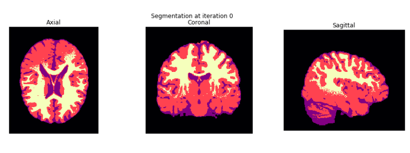 Initial Segmentation with our initialization of the GMM parameters.