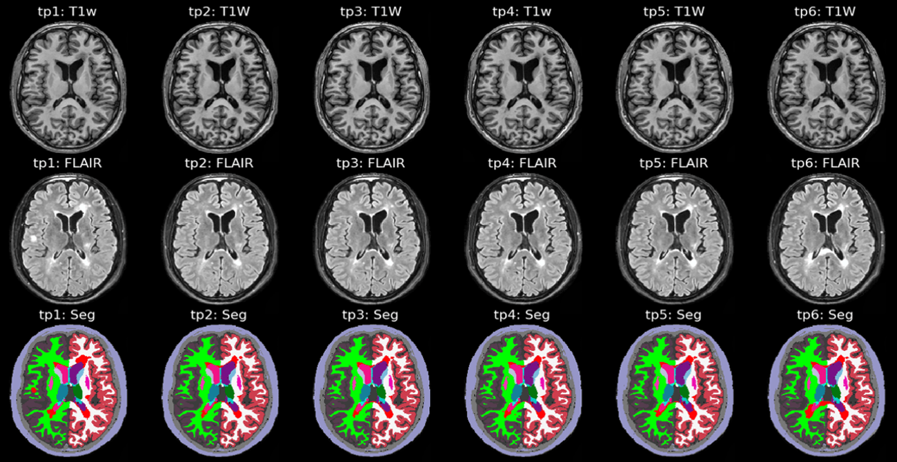 Longitudinal segmentation